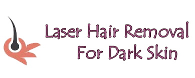 laser hair removal for dark skin